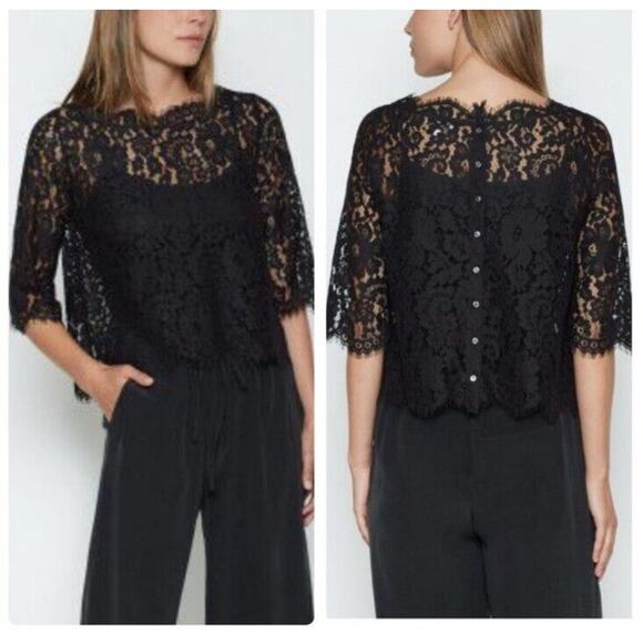 Joie Elvia Black Lace Top Size Small Metallic Button Back Cropped Sheer - Picture 3 of 12